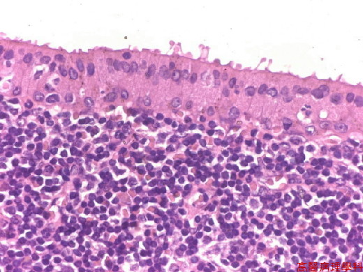  of this lymphoid tissue are large double-layered epithelial cells.
